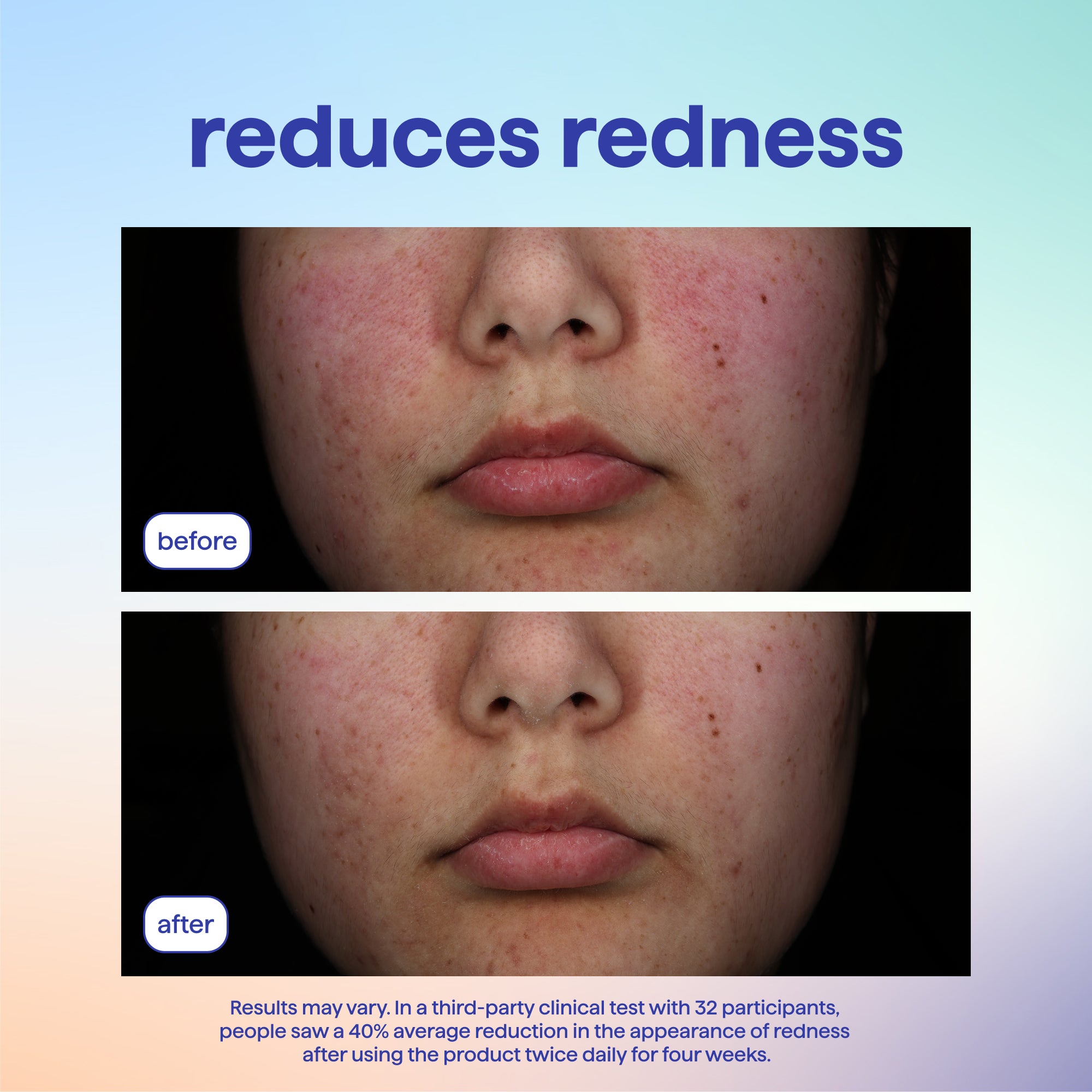 method-skin-spritz-face-body-mist-with-hypochlorous-acid-calming-spray-100-recyc image 5
